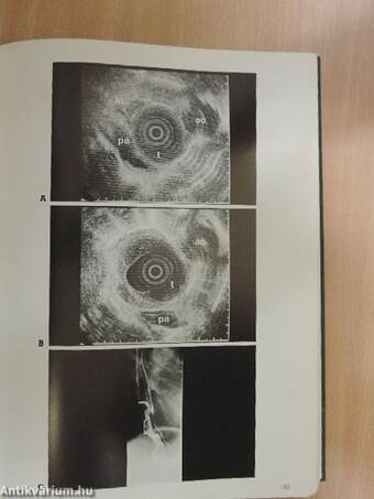 Atlas of transintestinal ultrasonography