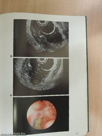 Atlas of transintestinal ultrasonography