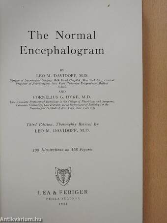 The Normal Encephalogram