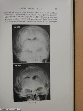 The Normal Encephalogram