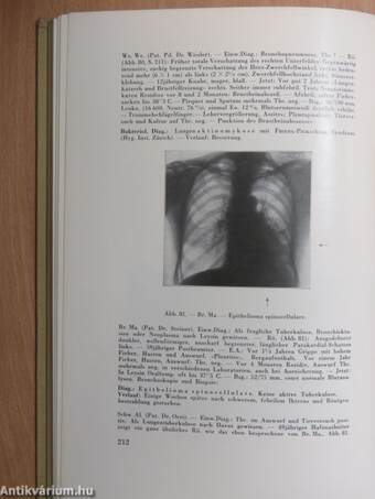 Differentialdiagnose der Lungenröntgenbilder