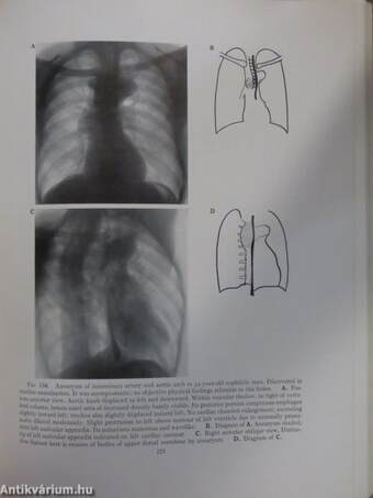 Clinical Roentgenology of the Heart