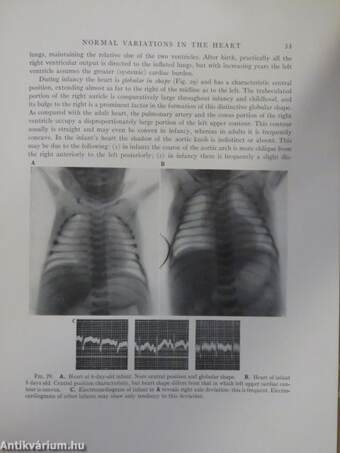 Clinical Roentgenology of the Heart