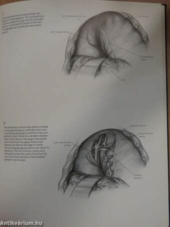 Surgical Techniques Illustrated Summer 1977