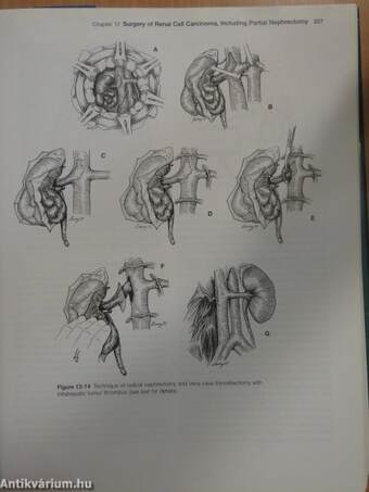 Urologic Oncology