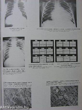 The Atlas of Endemic Diseases and Their Environments in the People's Republic of China