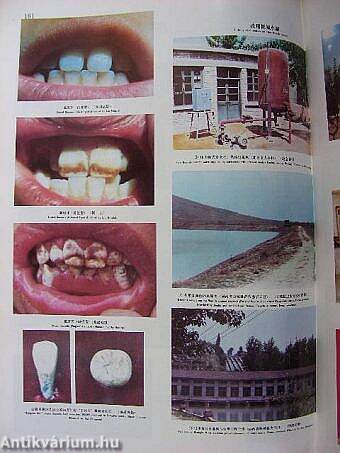 The Atlas of Endemic Diseases and Their Environments in the People's Republic of China