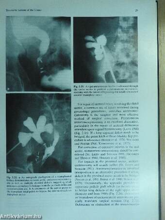 Radiology of the Lower Urinary Tract