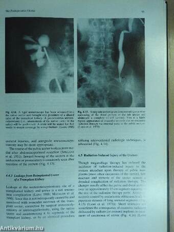 Radiology of the Lower Urinary Tract