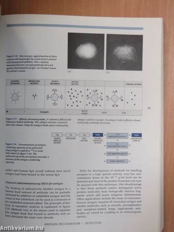 Essential immunology