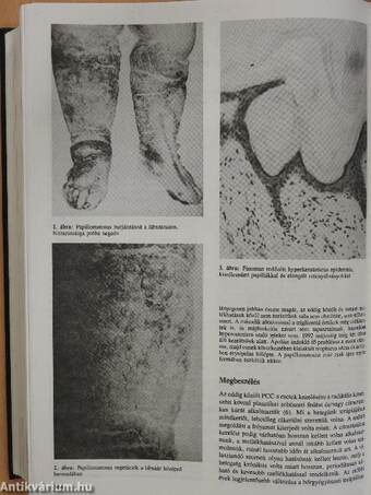 Orvosi hetilap 1993. január-december I-II.