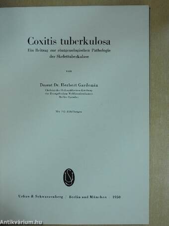 Coxitis tuberkulosa