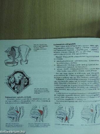 Szülészet-nőgyógyászat 3. (töredék)