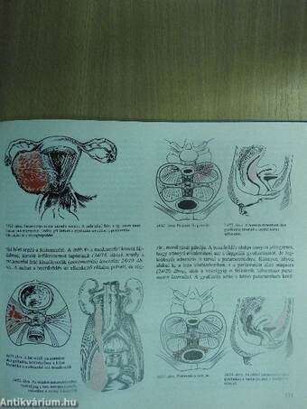 Szülészet-nőgyógyászat 3. (töredék)