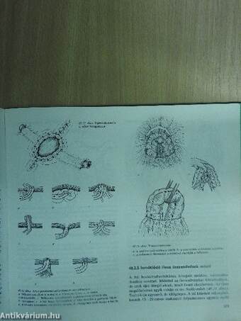 Szülészeti-nőgyógyászati műtéttan 2. (töredék)
