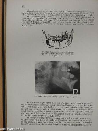 A száj és az állcsontok dentális betegségeinek sebészete