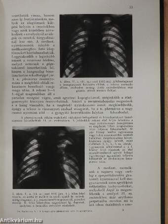 A lymphogranulomatosis kór- és gyógytana