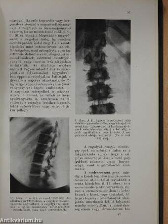 A lymphogranulomatosis kór- és gyógytana