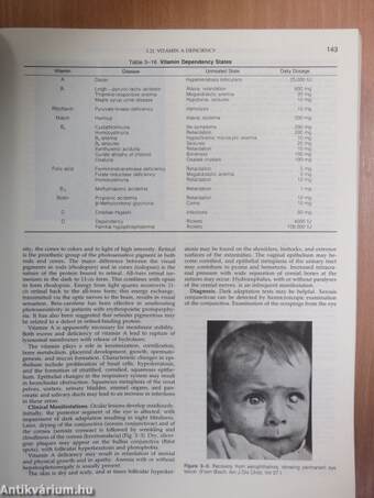 Nelson Textbook of Pediatrics