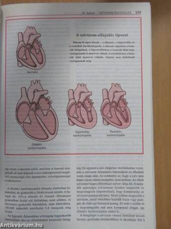 MSD Orvosi Kézikönyv a Családban