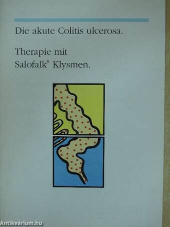 Die akute Colitis ulcerosa. Therapie mit Salofalk Klysmen.