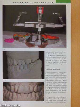Esztétika a fogászatban I. szám