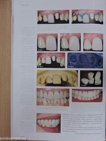 Dental Hírek 2015/4.