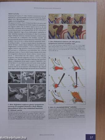 Otorhinolaryngologia Hungarica 2017/2.