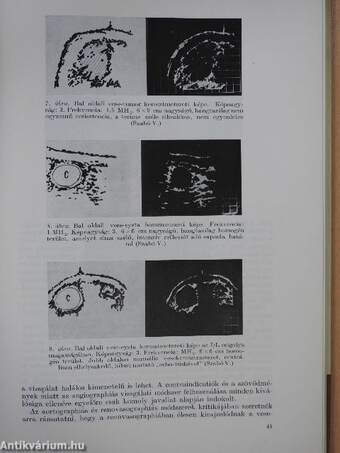 Megtévesztő kóresetek intraoperatív diagnózisa az urológiában (dedikált példány)