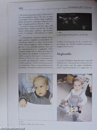 Gyermekgyógyászat 2003. július