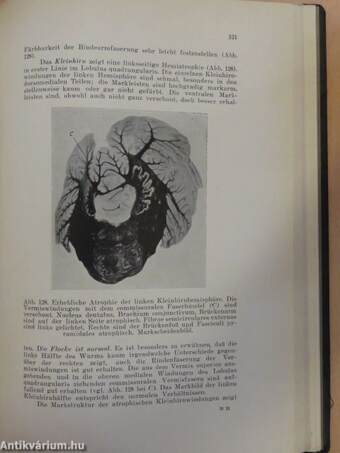 Histopathologie des Neurons