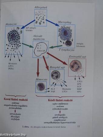 Allergiás Rhinitis