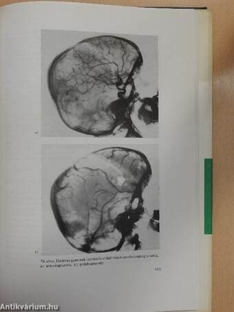 Ideggyógyászati és idegsebészeti vizsgálatok csecsemő- és gyermekkorban