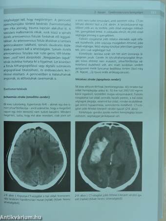 Gyakorlati neurológia és neuroanatómia