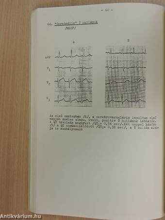 EKG-atlasz