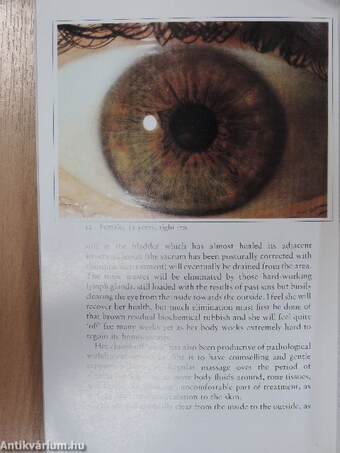 Iridology