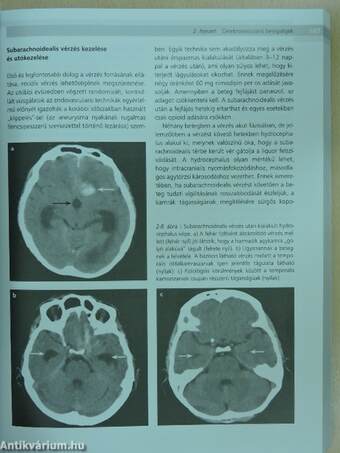 Gyakorlati neurológia és neuroanatómia