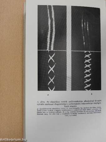 Elasztin és elasztáz az atherosclerosis-kutatásban