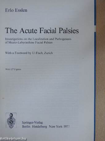 The Acute Facial Palsies 