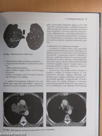 Tüdőrák a gyakorlatban