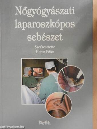 Nőgyógyászati laparoszkópos sebészet