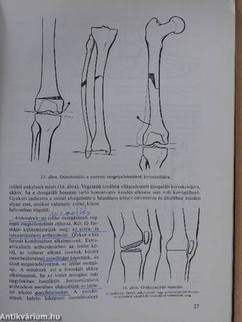 Az orthopaedia tankönyve