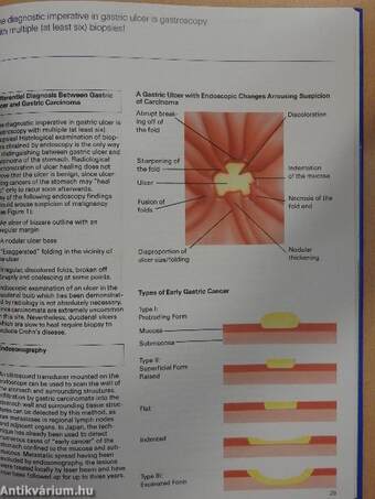 The Ulcer Patient in General Practice