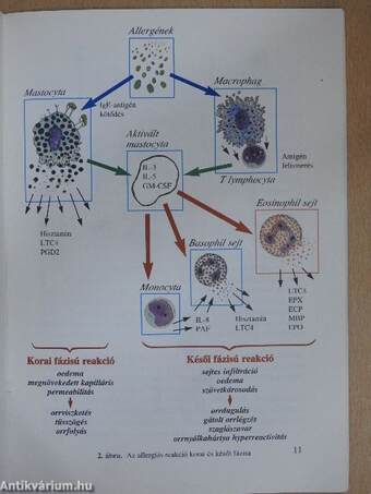 Allergiás Rhinitis