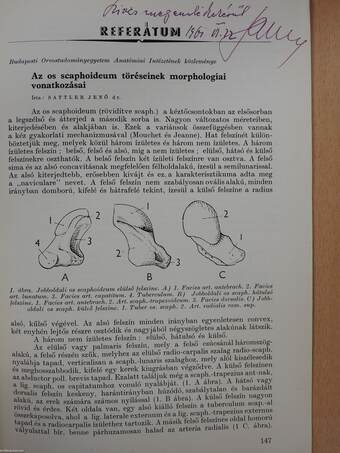 Az os scaphoideum töréseinek morphologiai vonatkozásai (dedikált példány)