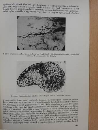 Az os scaphoideum töréseinek morphologiai vonatkozásai (dedikált példány)