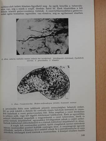 Az os scaphoideum töréseinek morphologiai vonatkozásai (dedikált példány)