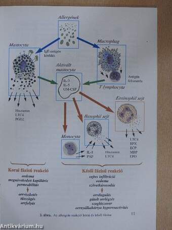 Allergiás Rhinitis