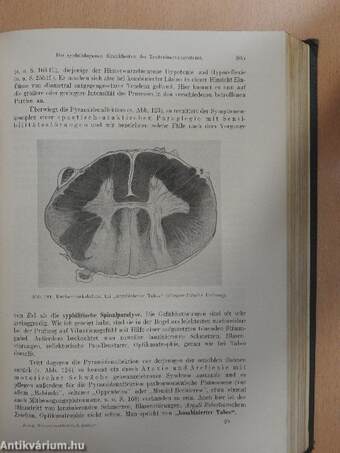 Lehrbuch der Nervenkrankheiten