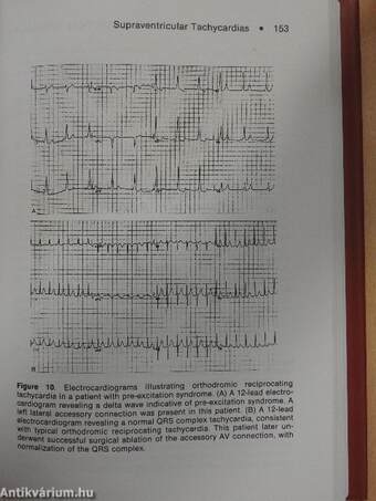 Cardiac Arrhythmias: A Practical Approach